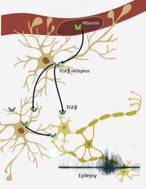 When the blood-brain barrier is disrupted by a severe head injury, the blood protein albumin leaks into the brain and activates the TGF-beta receptor on astrocytes (tan cells), which triggers a cascade of events leading to inflammation. The net result can be hyperexcitable neurons (yellow) and epileptic seizures. Kaufer, Friedman and colleagues discovered this cause and effect and identified a drug that blocks the TGF-beta receptor, preventing seizures in rats. Credit: Greg Chin, Vlad Senatorov and Oscar Vasquez (UC Berkeley)
