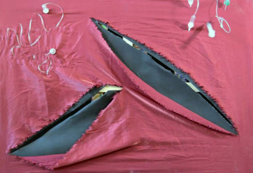 Slashed Material at Ezer Mizion Cancer Survivor Exhibit
